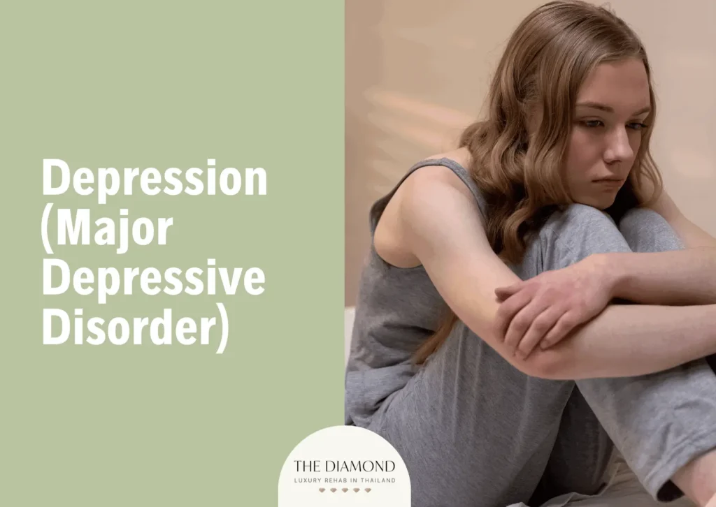 create alt text ,title, description ; Major Depressive Disorder VA Rating
